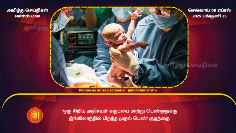 08.04.2025 - Baby Amy is the first child born in the UK