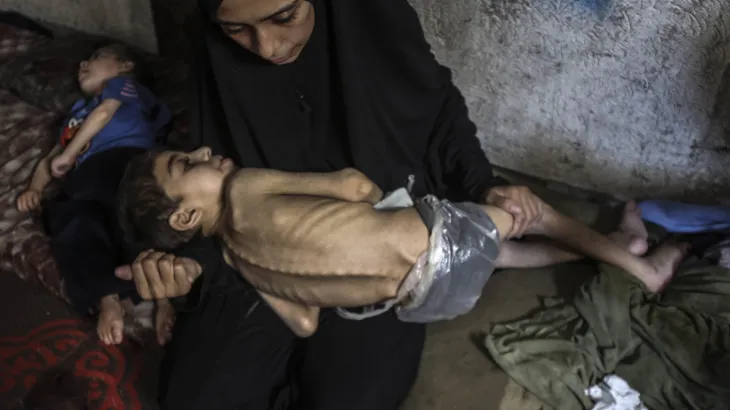 Gaza Starving