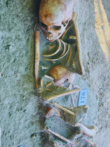 Chemmani Human Mass Graves - Identification of two interlocking bone fragments (1)